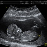 2 Boyutlu ultrason resmi