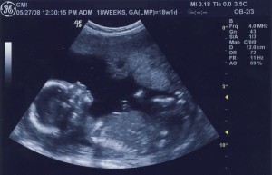 gebelik-18-hafta-bebek-ultrasonu
